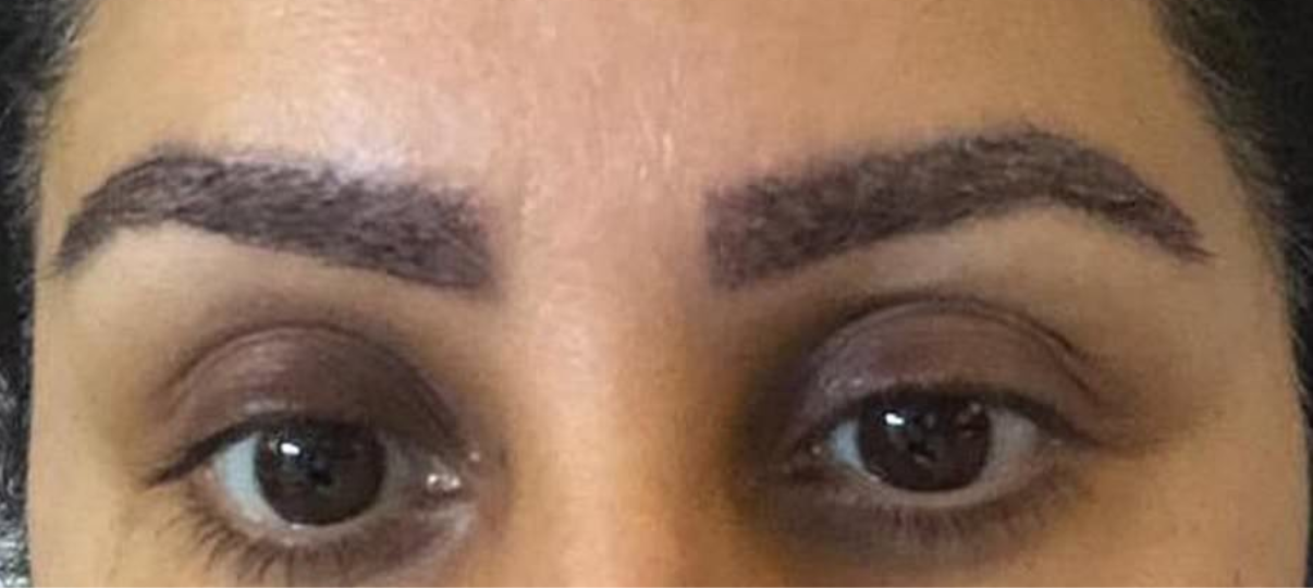 After Treatment
