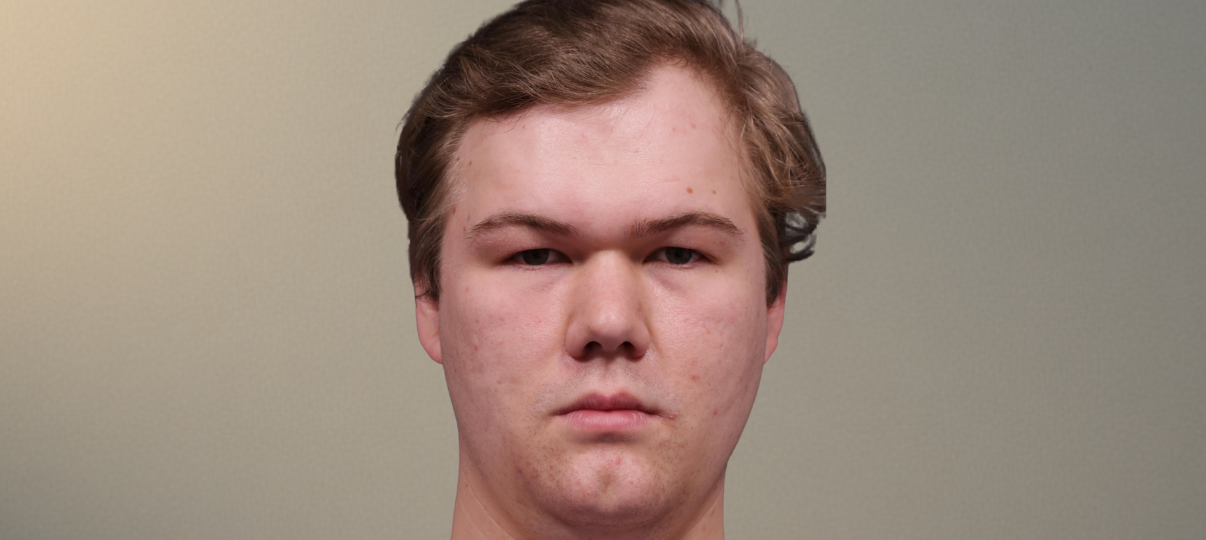 Before Treatment