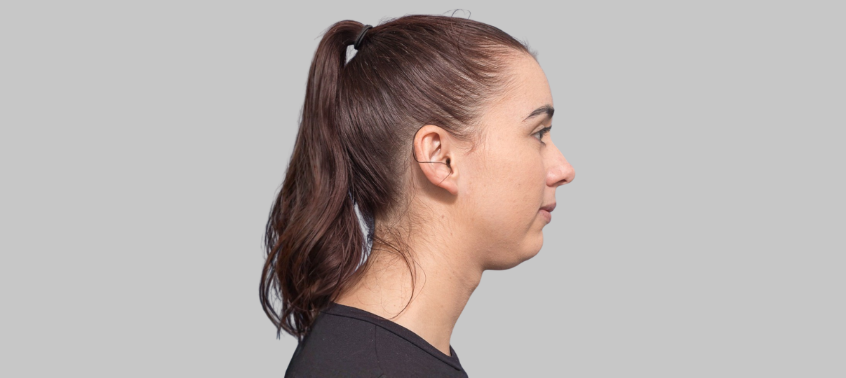 Before Treatment