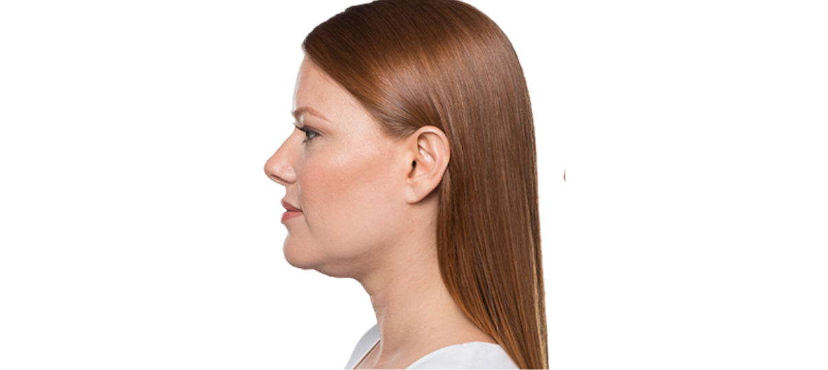 Before Treatment