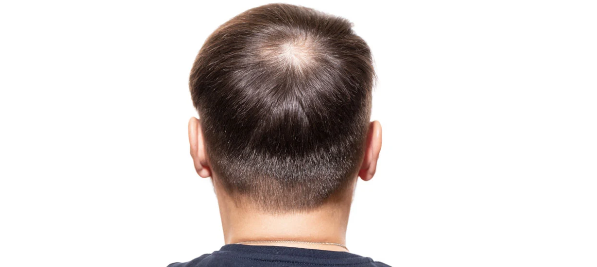 Before Treatment