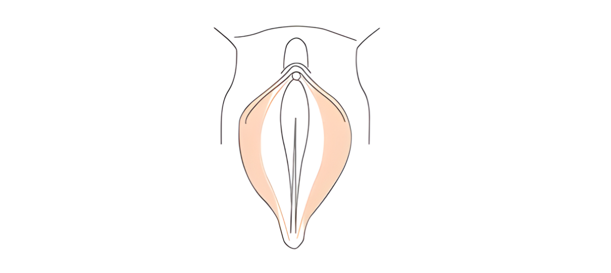 Before Treatment
