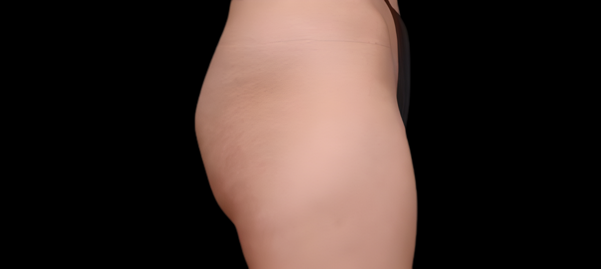Before Treatment